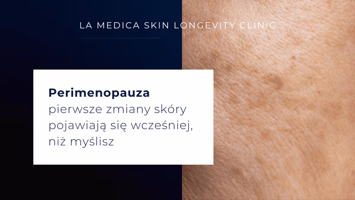 Perimenopauza – pierwsze zmiany skory pojawiaja sie wczesniej niz myslisz 1